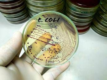 da salmonella a listeria a e coli ipotesi in campo in tossinfezioni alimentari 2