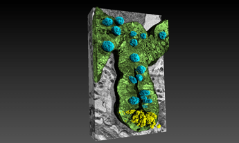 rivelato il legame intestino cervello nellalzheimer grazie ai raggi x 2